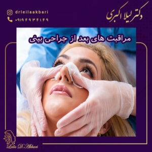 مراقبت های بعد از جراحی بینی - دکتر لیلا اکبری