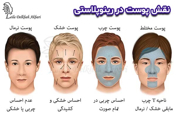 جراحی بینی در تهران - دکتر لیلا اکبری
